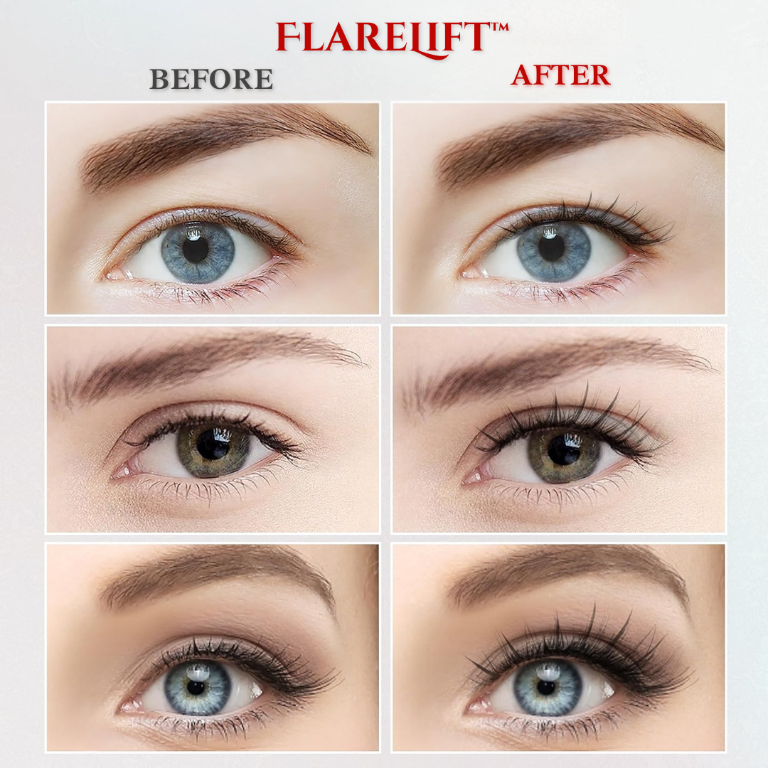 FlareLift™